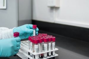 Lab - Ampullen - Forschung - Biotech